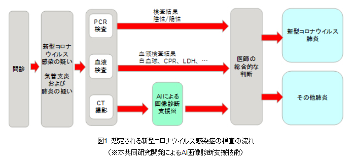 画像診断