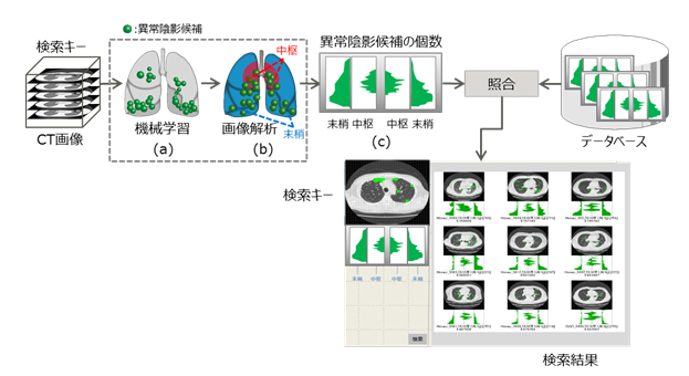 CT画像類似症例検索